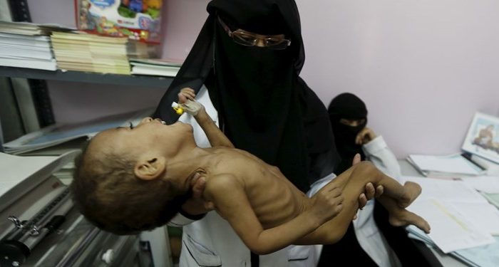 مرگ ۱ مادر و ۶ نوزاد یمنی در هر دو ساعت
