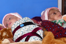 در سه ماه اول سال جاری میلادی به ۲۱۰هزار کودک و ۱۴۰ هزار مادر سوء تغذیه خدمات ارائه شده است