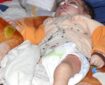سازمان داکتران بدون مرز:پنج هزار کودک مشکوک به ابتلا به بیماری سرخکان را بستری کرده‎‌است