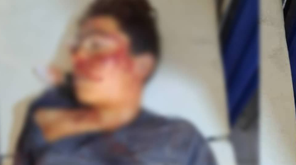 خودکشی یک نوجوان ۱۷ ساله در بلخ