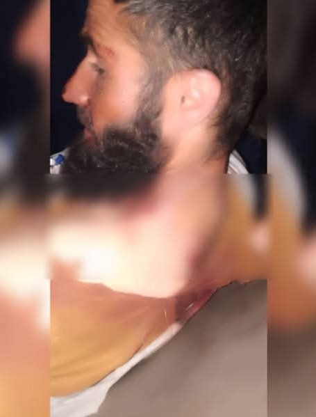 آمر مالی کندک سرحدی طالبان در بدخشان در حمله مسلحانه زخمی شد
