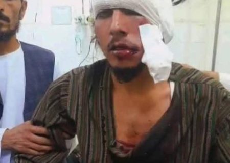فرمانده پیشین طالبان در بدخشان به‌دلیل عبور یک جوان از برابر خودرو‌اش، به دهان او شلیک کرد
