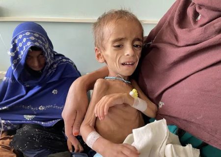 یونیسف: ۱.۳ میلیون کودک مبتلا به سوءتغذیه حاد در افغانستان در سال ۲۰۲۶ درمان می‌شوند