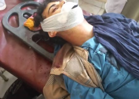 انفجار «پتاقی» در عروسی جان یک جوان بدخشانی را گرفت