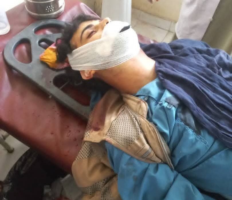 انفجار «پتاقی» در عروسی جان یک جوان بدخشانی را گرفت