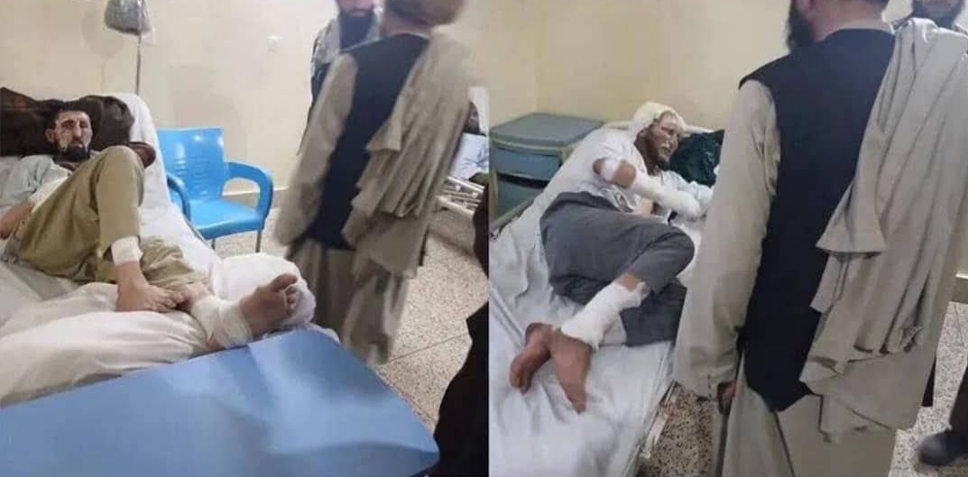 آتشسوزی در کندک نیروهای سرحدی طالبان در بدخشان، ۶ کشته و زخمی برجا گذاشت