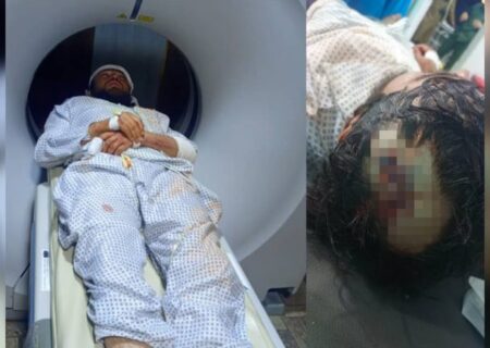 کارمند حقوق بلخاب پس از لت‌وکوب منسوبان ولسوال طالبان برای جراحی مغز به کابل منتقل شد