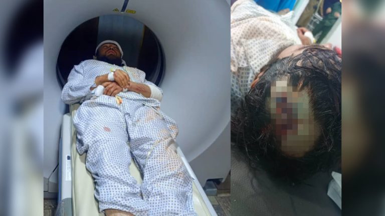 کارمند حقوق بلخاب پس از لت‌وکوب منسوبان ولسوال طالبان برای جراحی مغز به کابل منتقل شد